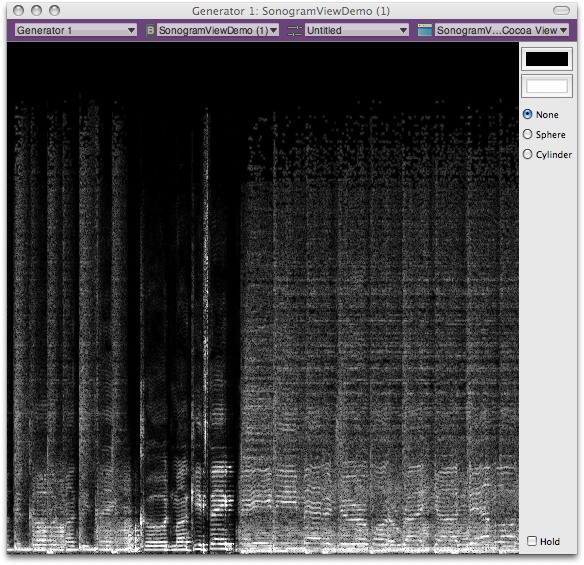 Figure 1, Sonogram View 